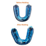 STRYK Impact Core Mouth Guard - Image 5